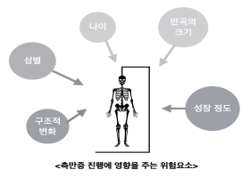 척추 측만증의 평가 방법