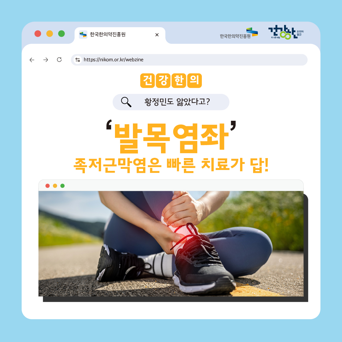 한국한의약진흥원 건강한(한의약웹진)
https://nikom.or.kr/webzine

건강한의
(황정민도 앓았다고?)
'발목염좌' 족적근막염은 빠른 치료가 답!