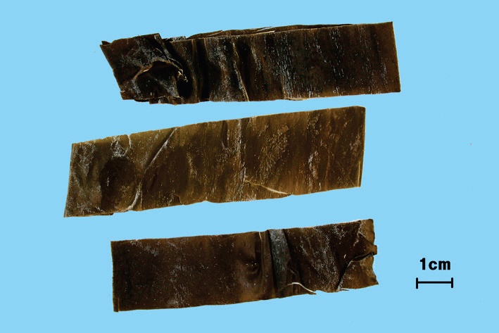 곤포 대표 이미지